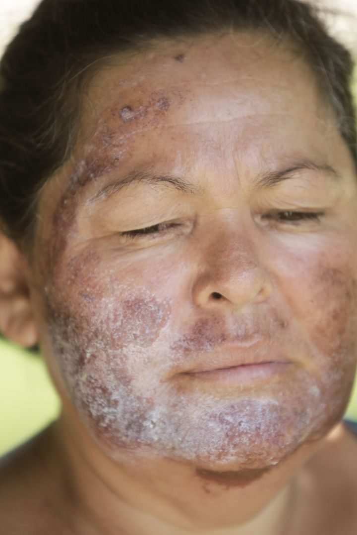 Provoca río Sonora casos de intoxicación